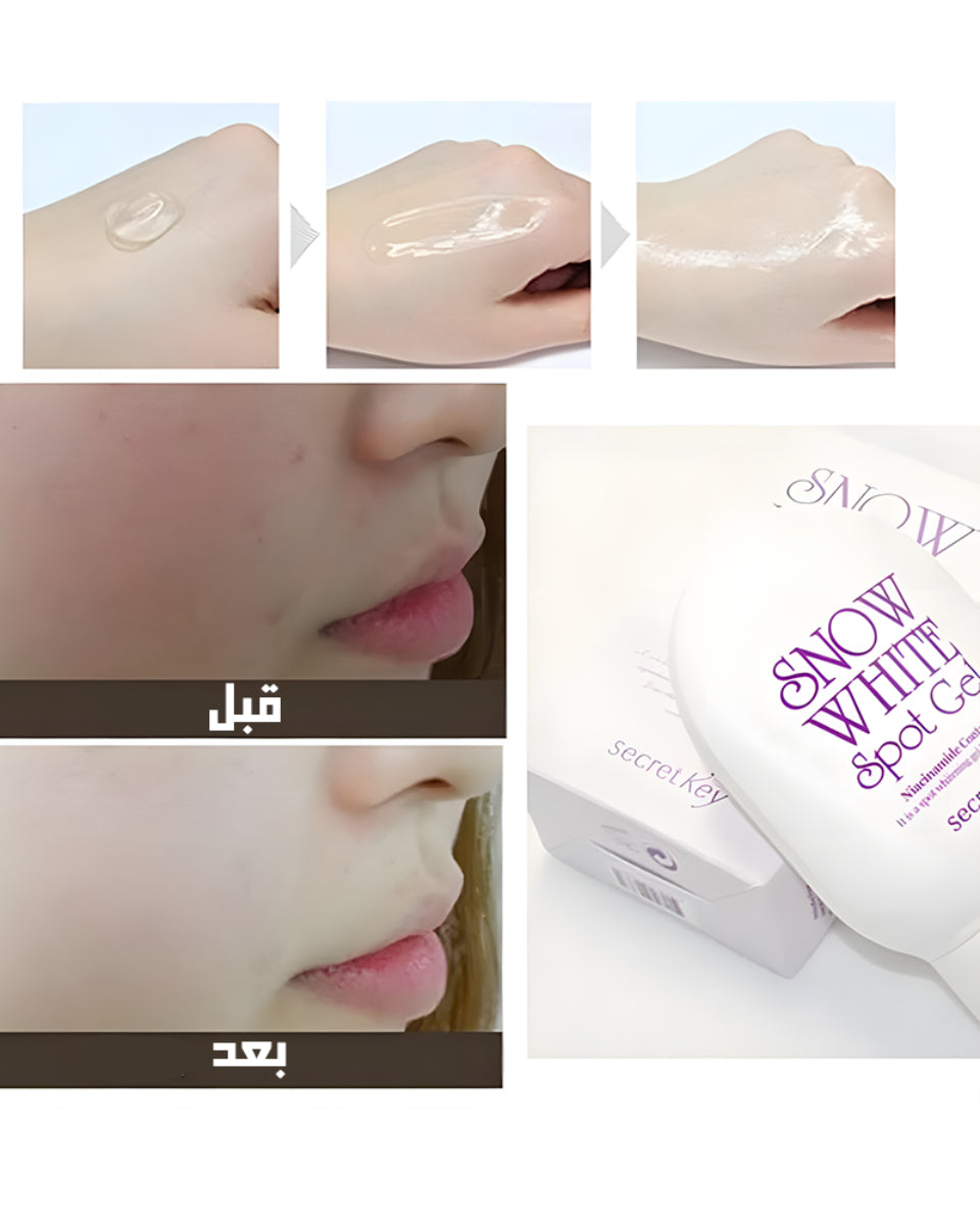 Secret Key Snow White Spot Gel - جل تفتيح البشرة سنو وايت